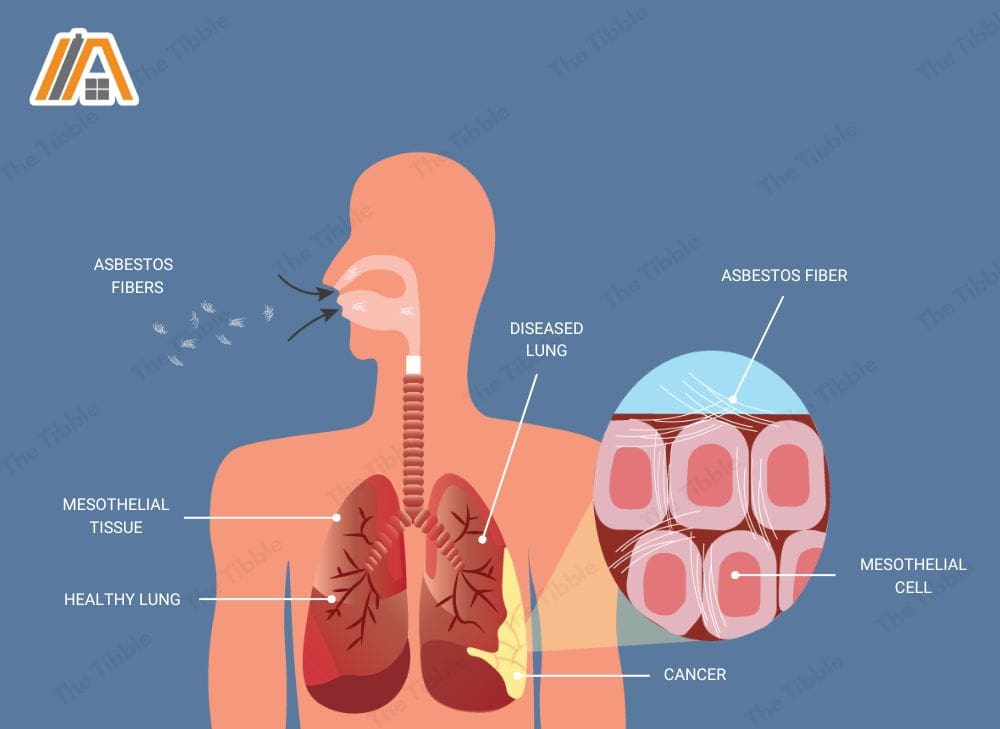 Inhaling asbestos fibers that can cause cancer, asbestosis illustration