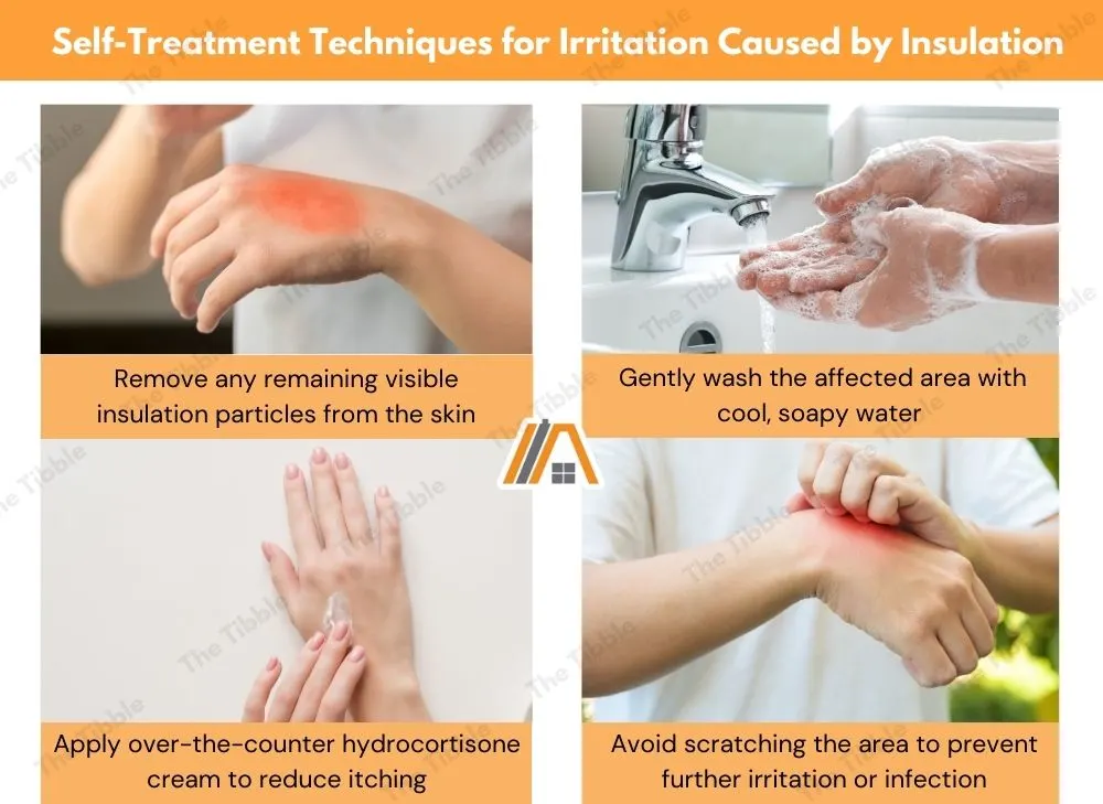 Self-Treatment Techniques for Irritation Caused by Insulation Infographic