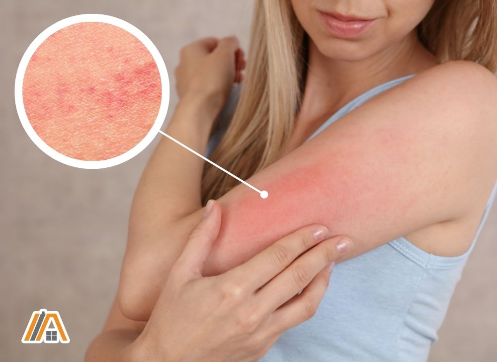 Woman scratching irritated skin